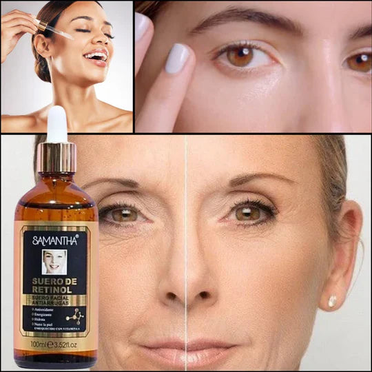SUERO DE RETINOL PRO - ANTIENVEJECIMIENTO 100ML